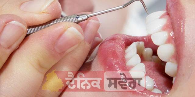 Teeth Care : ਦੰਦਾਂ ਲਈ ਹਾਨੀਕਾਰਕ ਇਹ 10 ਚੀਜ਼ਾਂ ; ਹੁਣੇ ਕਰੋ ਬੰਦ ਵਰਨਾ&hellip;!