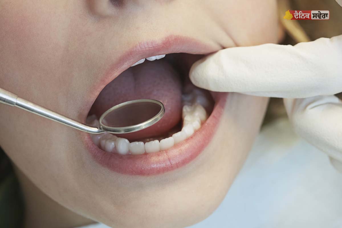 Dental Care Mistake : ਦੰਦਾਂ ਦੀ ਬਾਹਰੀ ਪਰਤ ਨੂੰ ਕਮਜ਼ੋਰ ਕਰ ਦਿੰਦੀਆਂ ਇਹ 5 ਗਲਤੀਆਂ ? ਅੱਜ ਹੀ ਕਰੋ ਸੁਧਾਰ