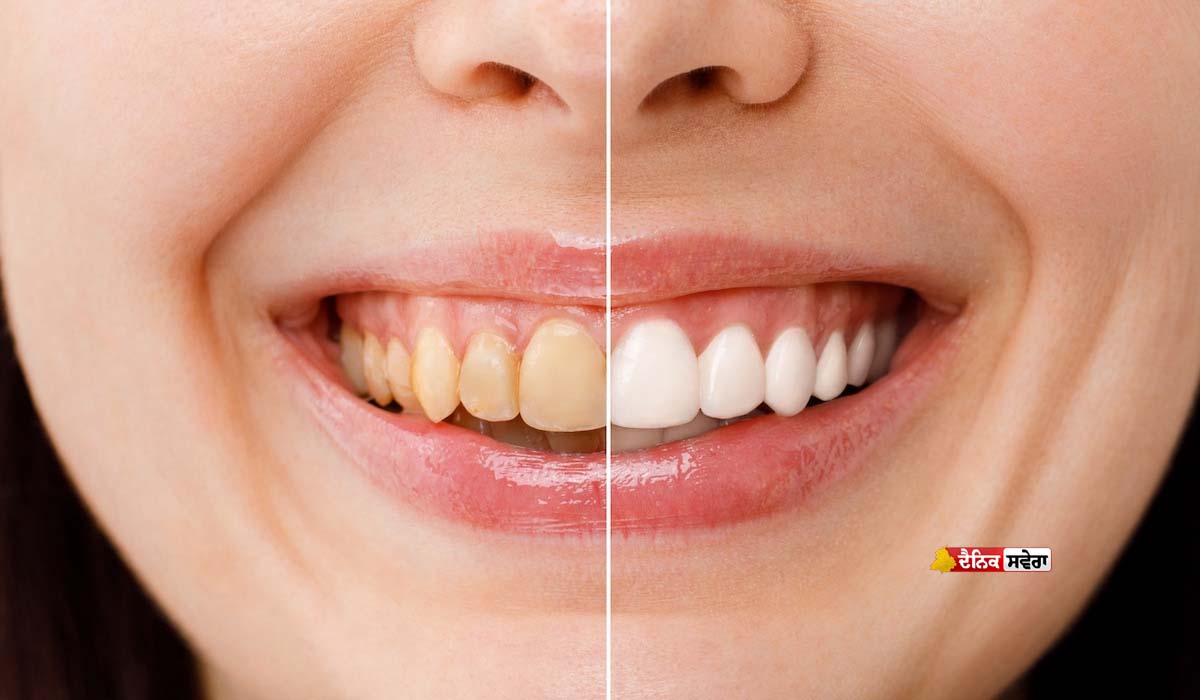 World Oral Health Day : ਦੰਦਾਂ ਅਤੇ ਮਸੂੜਿਆਂ ਦਾ ਦਿਮਾਗ ਦੀ ਸਿਹਤ ਨਾਲ ਕੀ ਹੈ ਕੁਨੈਕਸ਼ਨ ? ਇੱਥੇ ਜਾਣੋ&hellip;