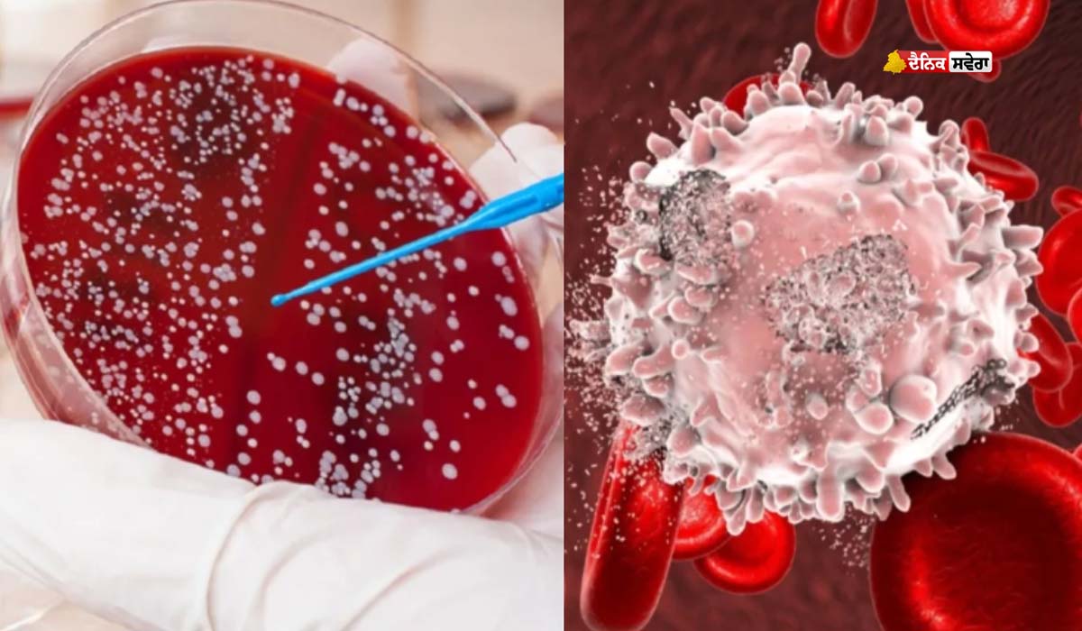 Early Signs of Cancer : ਸਰੀਰ &lsquo;ਚ ਕੈਂਸਰ ਦਾ ਪਹਿਲਾ ਸੰਕੇਤ ਕੀ ਹੈ ? ਕਦੋਂ ਹੋਈਏ ਸਾਵਧਾਨ ! ਜਾਣੋ ਡਾਕਟਰ ਦੀ ਰਾਏ