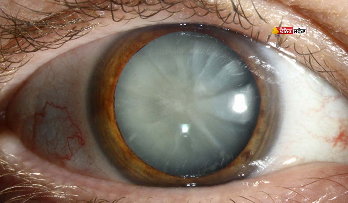 Eyes Care : ਧੁੰਦਲੀ ਨਜ਼ਰ ਨੂੰ ਨਾ ਕਰੋ ਨਜ਼ਰਅੰਦਾਜ਼ ; ਇਹ ਲੱਛਣ ਹੋ ਸਕਦੇ ਖ਼ਤਰਨਾਕ, ਜਾਣੋ ਕਿਵੇਂ ਕਰੀਏ ਆਪਣਾ ਬਚਾਅ