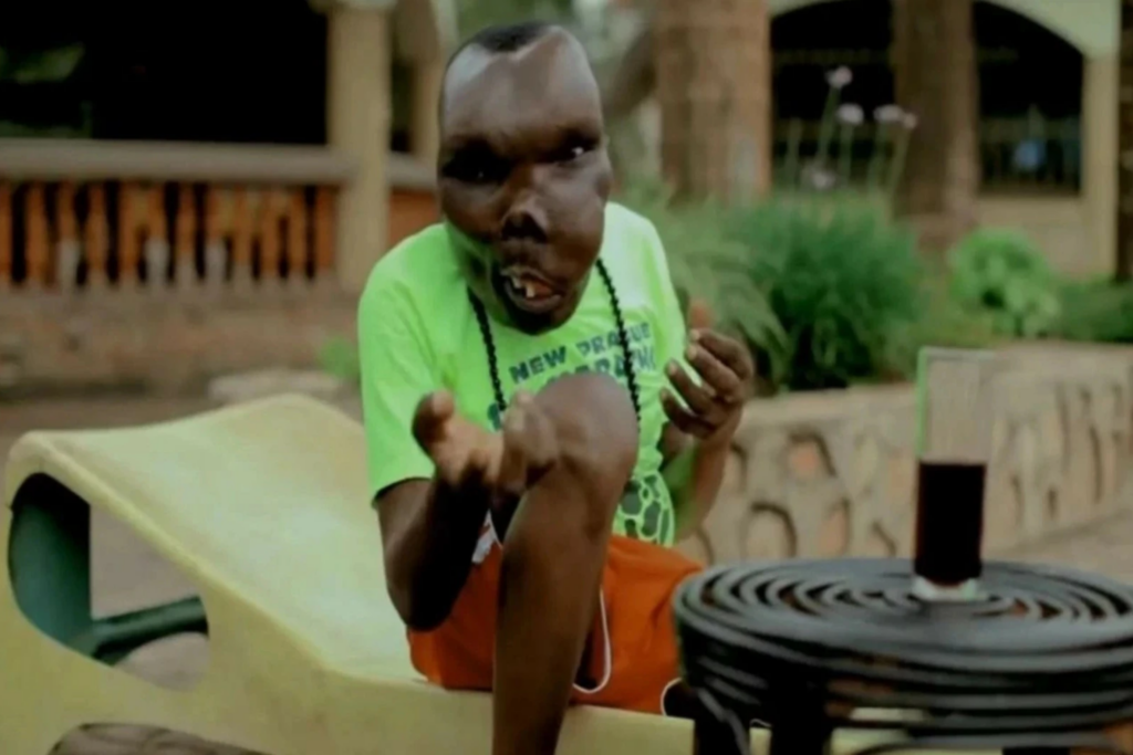 The Amazing Story of Godfrey Baguma: A Successful Artist Who Courageously Survived a Rare Disease